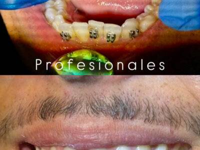 Odontologia general e infantil